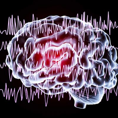 Image of a brain with simulated brainwaves 